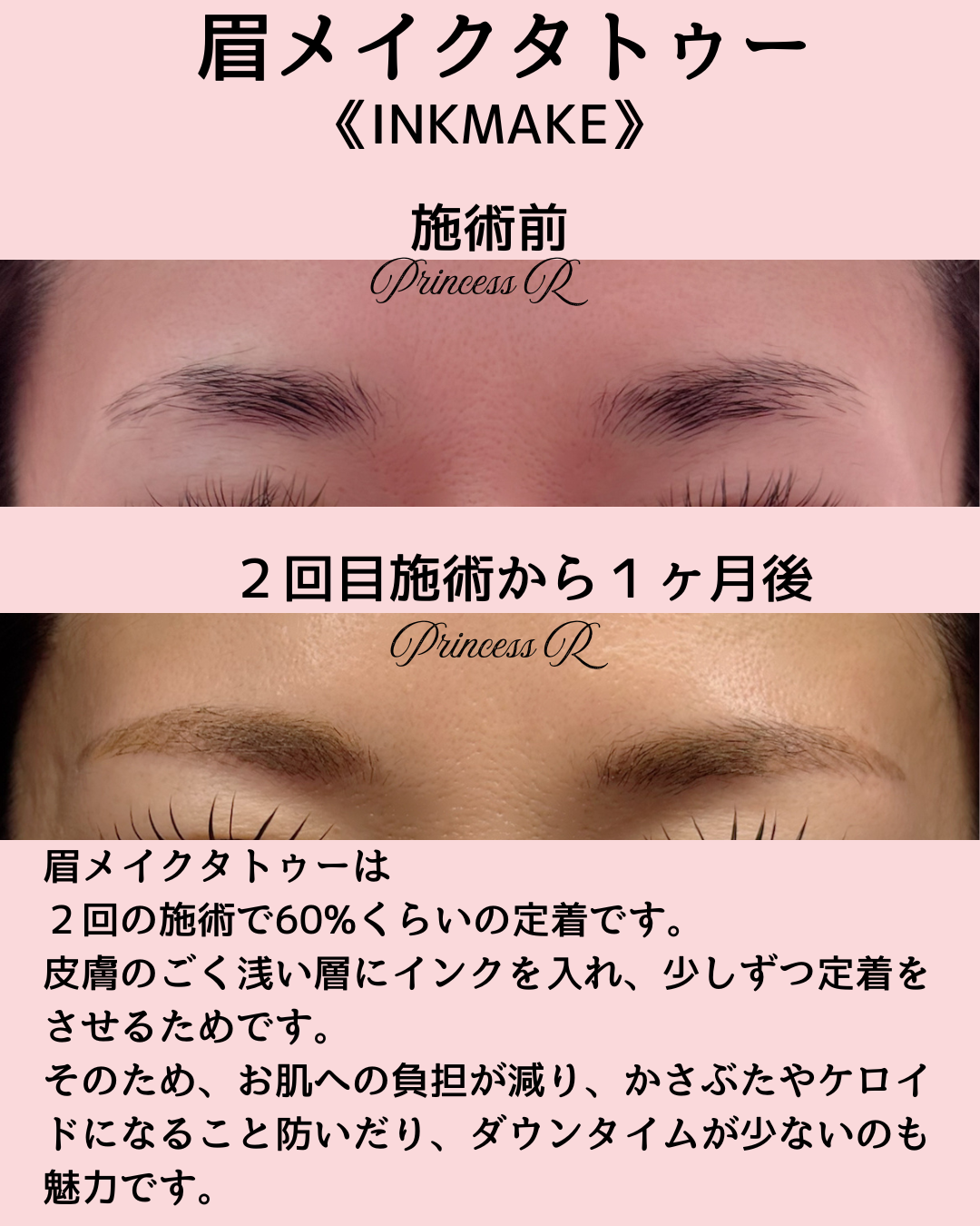 施術前.zip - 2