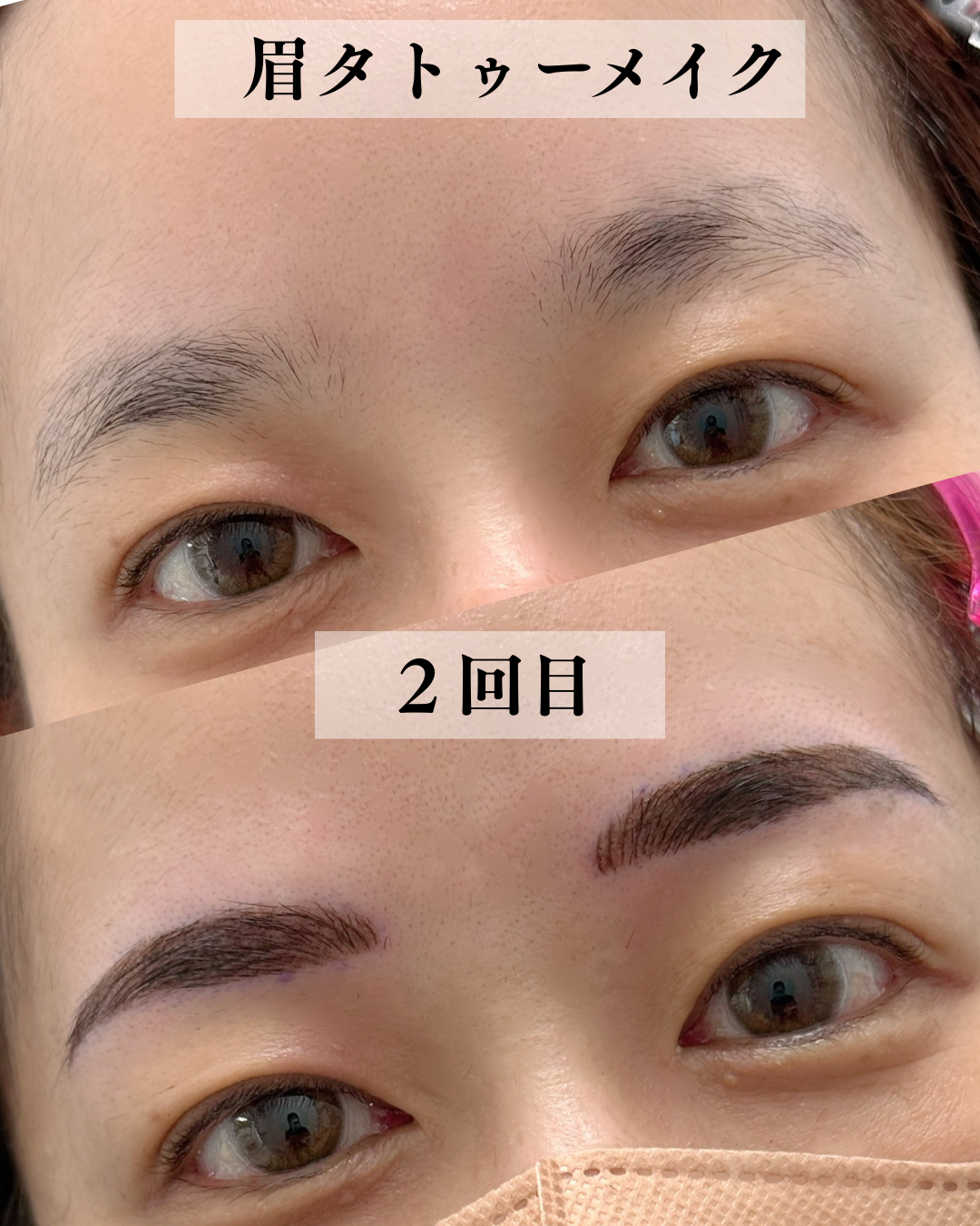 １回目から１ヶ月後.zip - 2